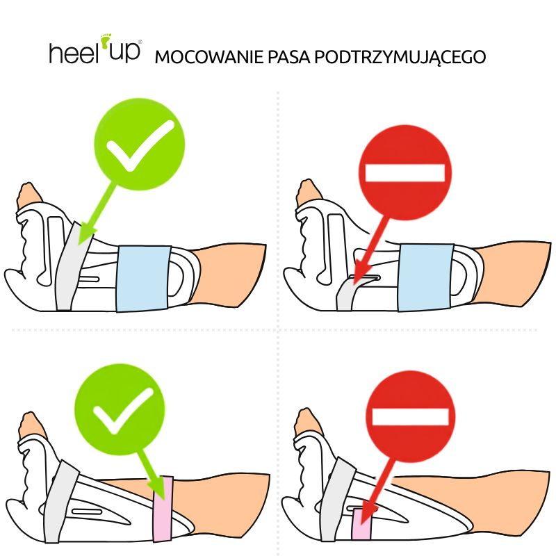 Ochraniacz pięty z wycięciem na owrzodzenia Heel Up CUT Medium dla diabetyków